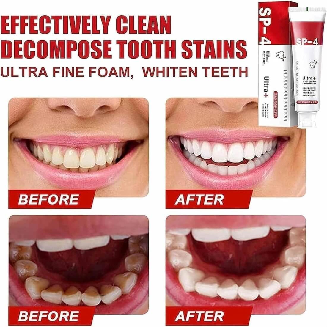 Product for Website - 2 Yayashi SP-4 Ultra Whitening Toothpaste | Stain Remover & Fresh Breath Formula - Image 4