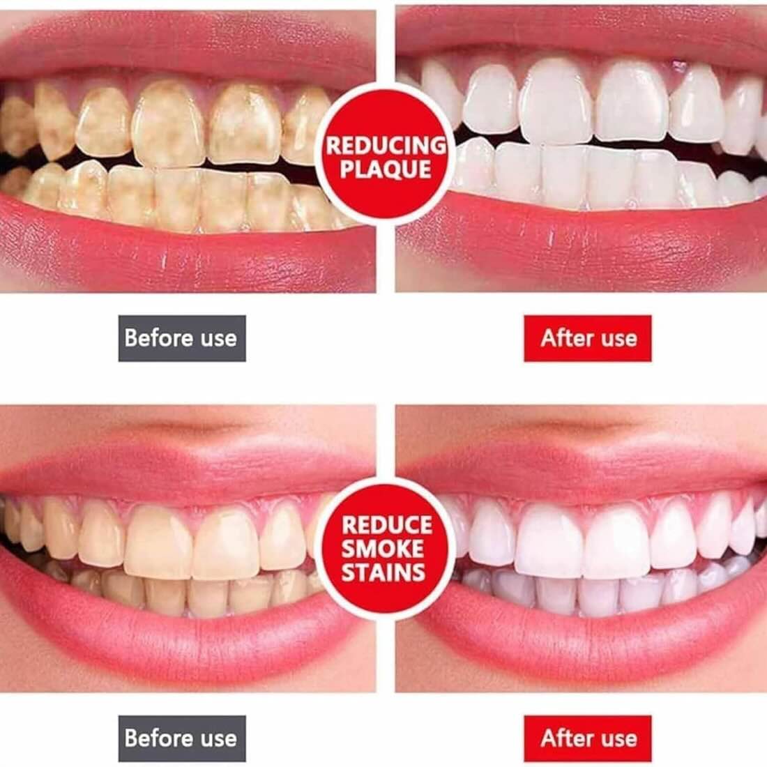 Product for Website - 4 Yayashi SP-4 Ultra Whitening Toothpaste | Stain Remover & Fresh Breath Formula - Image 2