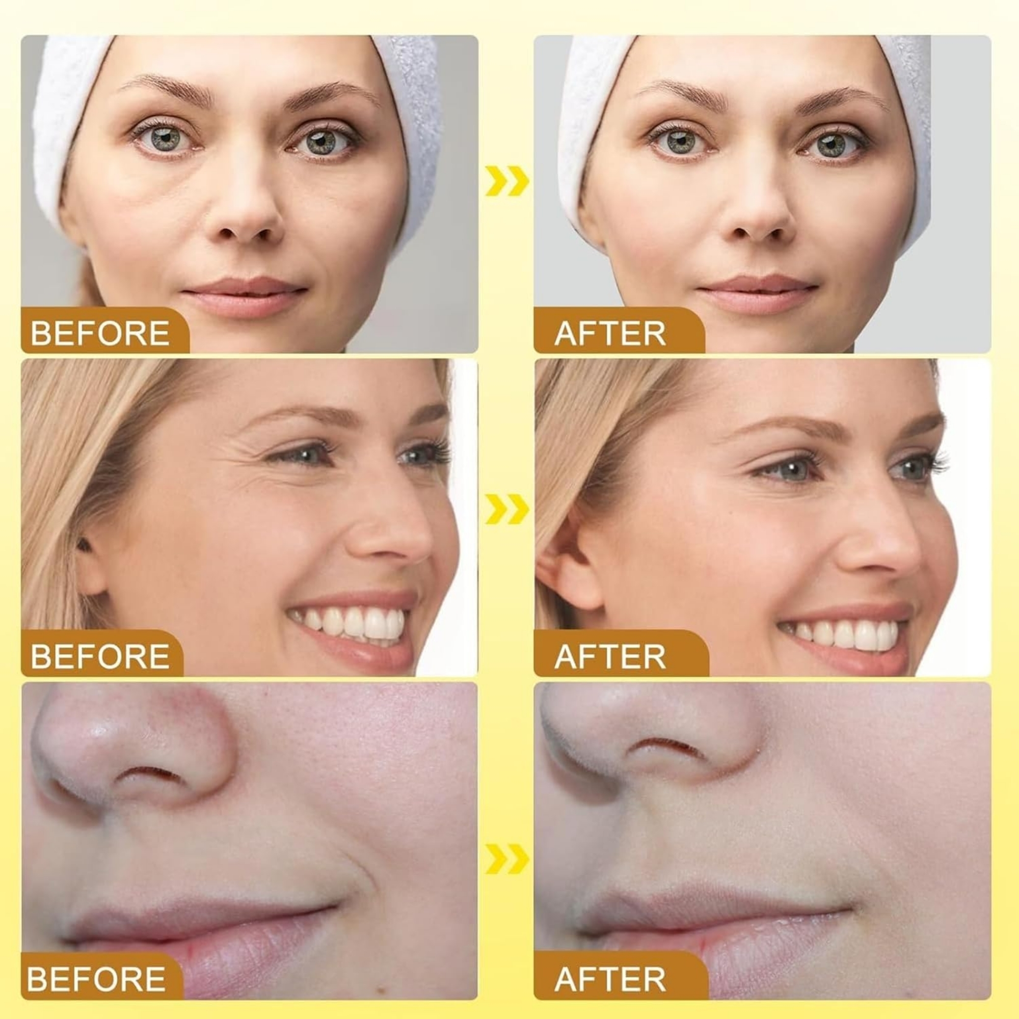 botox9_1757932217.jpg Botox Bee Venom Wrinkle Cream in Pakistan | Anti-Aging & Collagen Boosting Moisturizer - Image 8
