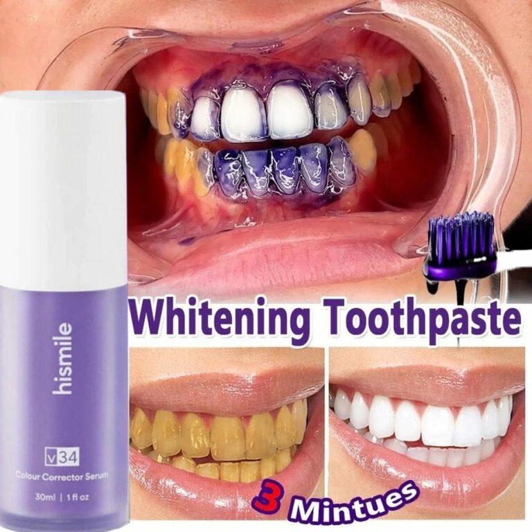 Hismile V34 Color Corrector Serum | Instant Teeth Brightening Solution | 30ml - Image 2